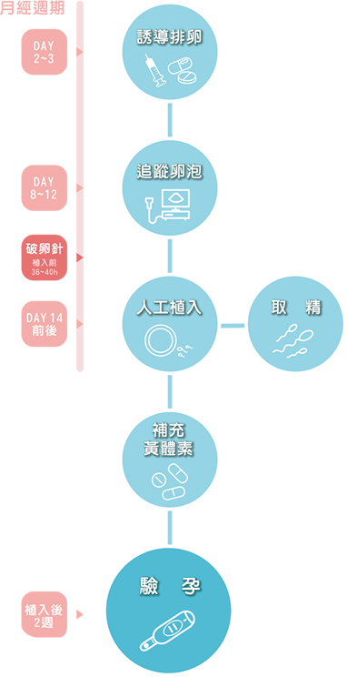 人工授精IUI流程